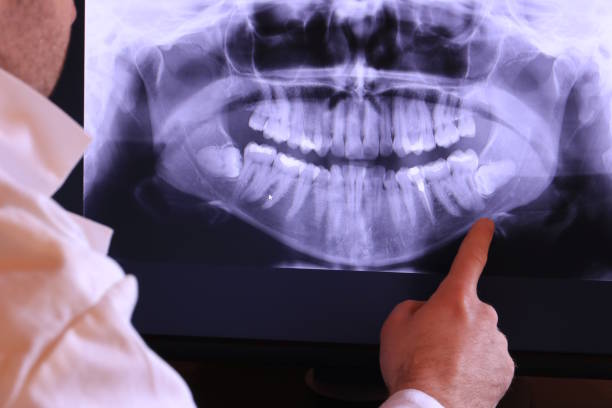 Best Urgent Tooth Repair  in Lmerton, PA