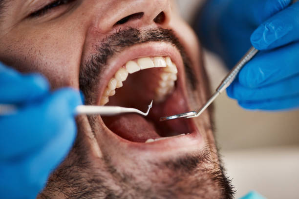 Best Broken Tooth Emergency  in Lmerton, PA